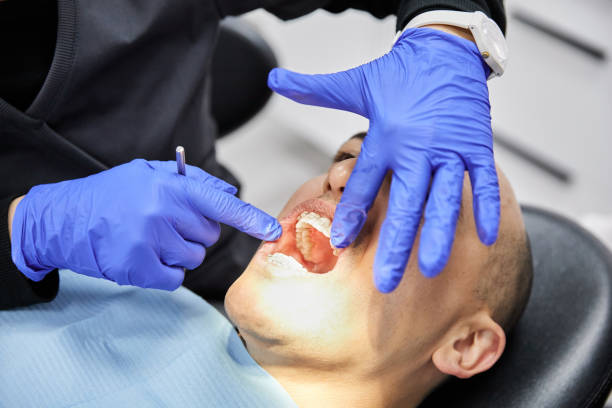 Best Emergency Dental Care for Broken or Chipped Teeth in Waldwick, NJ