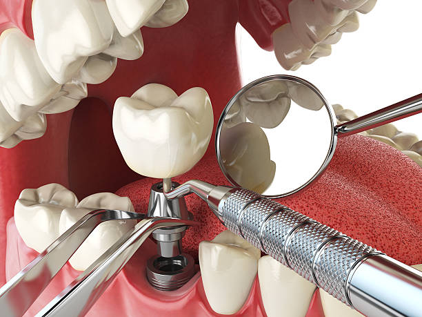 Best Emergency Gum Treatment in Waldwick, NJ